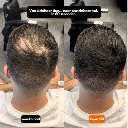 HaarHeld™ voor mannen