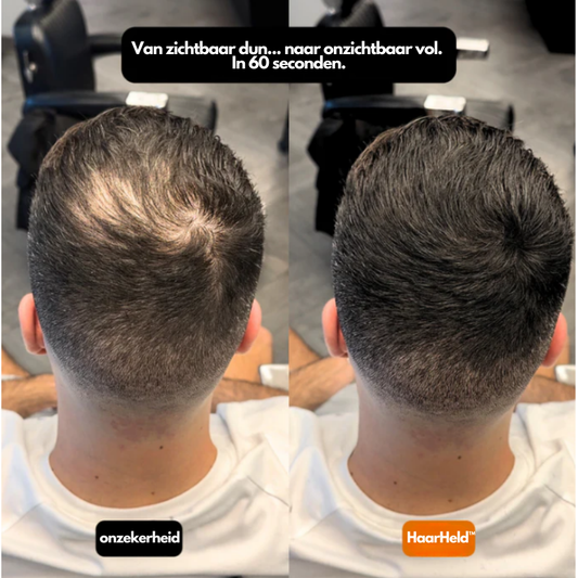 HaarHeld™ voor mannen