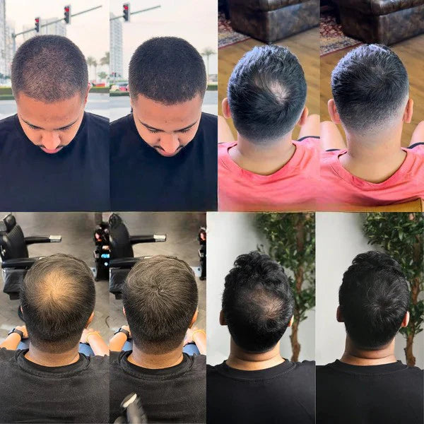 HaarHeld™ voor mannen