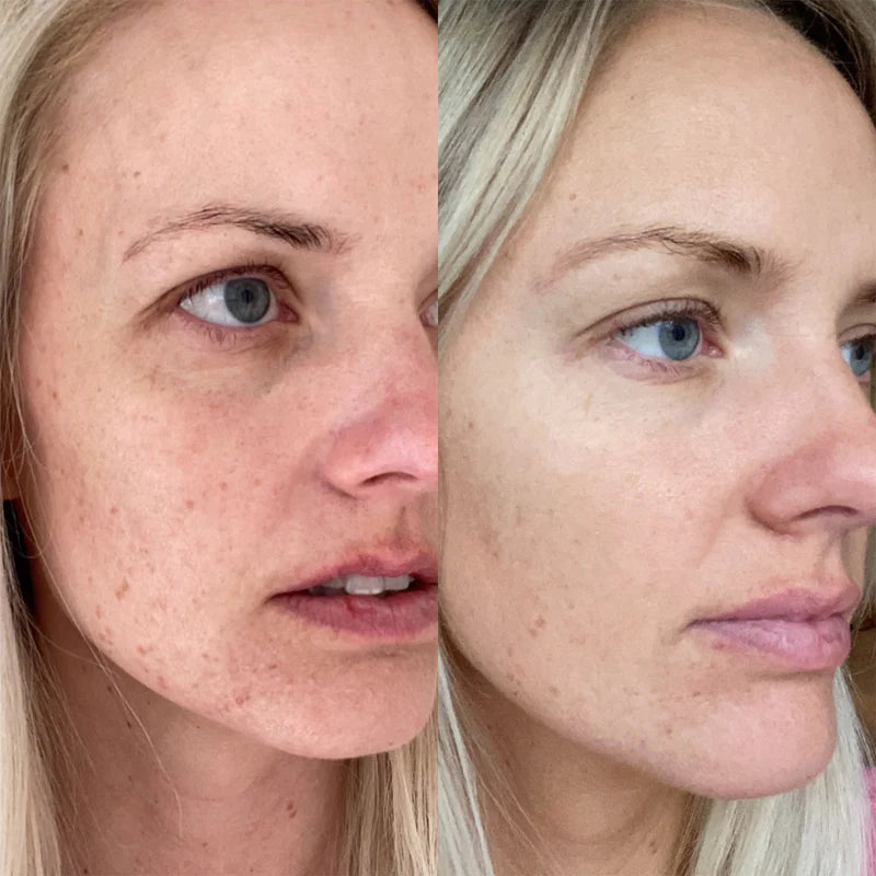 before-after_linda_medik8dermaceutic (1).webp__PID:8ab672be-890b-4fa9-bbf6-6d4f73e7e422