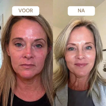 Korean Retinal Shot Duo™