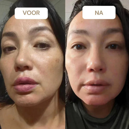 Korean Retinal Shot Duo™